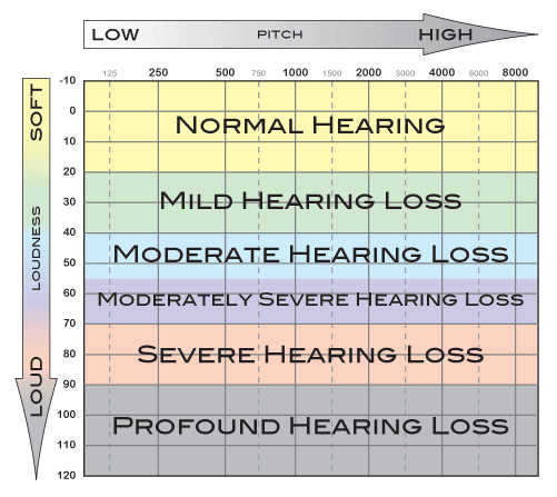 Audiograms, Audiogram For Berard AIT, Audiogram Hyper Acute Hearing ...